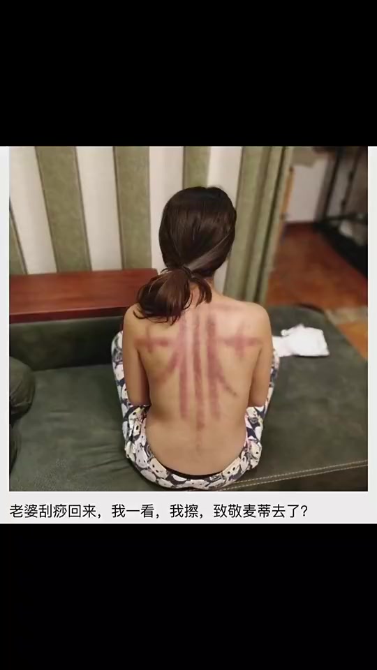 老婆這刮痧是去致敬麥迪嗎還真有點像啊